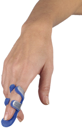 F&eacute;rula de rana